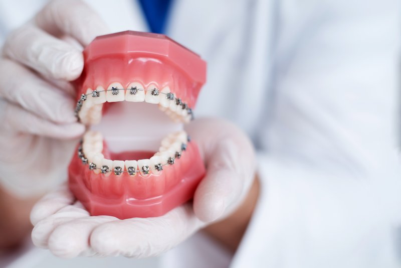 a dentist holding an example of traditional braces in Frisco